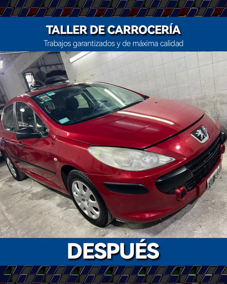Carroceria Después